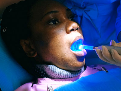 Root Canal Treatment